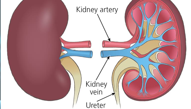 Kidney-Transplant